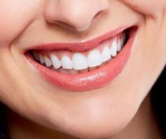 Transform Your Smile Instantly with Fake Teeth Veneers: Esthetica Dental Chandigarh