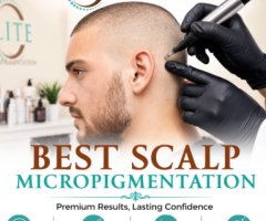 Transform Your Look with Scalp Micropigmentation