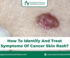 Here You Know about different types of Cancer that may causes Skin Rash?