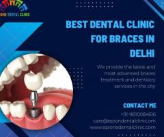 Best Dental Clinic for Braces in Delhi