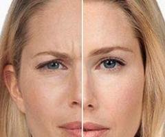 Natural Injectables & Botox Fort Worth, TX | Hidden Door Spa