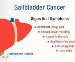 Gallbladder Cancer | Symptoms, Causes & Treatment | Medanta