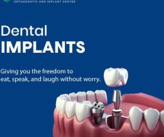 Best dental implants in nagaram | risus dental clinic