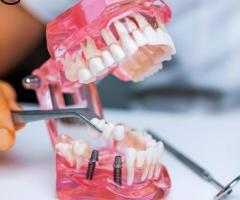 Best Dentist in Juhu, Bandra, Khar, Santacruz, Andheri Mumbai