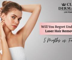 Underarm Laser Hair Removal