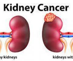 Kidney Cancer - Causes, Symptoms & Treatment | Medanta