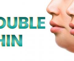 Double Chin Fat Dissolving Injections in Islamabad - R M C