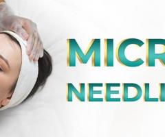 Microneedling with PRP in Islamabad - R M C