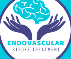 Stroke Treatment - Brain Stroke Centre in India