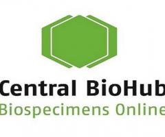 Cytology samples for research | Biospecimens Online