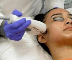 Glow Skin Moxi Laser Fort Worth, TX | Hidden Door Spa