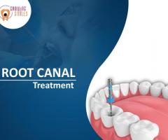 Root Canal Treatment in Whitefield: Growing Smiles