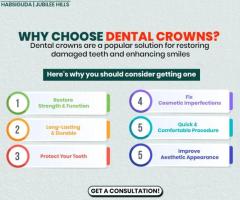 Looking for Best Dental Crowns Dentistry in Hyderabad - Roots Dental Care