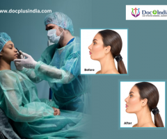 Reclaim Your Self-Confidence With best cosmetic surgery centre in Bangalore