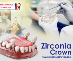 Restoration of your damaged teeth with zirconia crowns: Smiles N Aesthetics