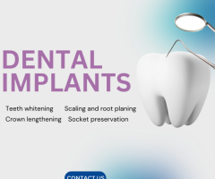 Is Dental Implants Placement Painful ?