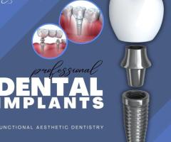 Experience Superior Dental Implant Solutions in Summerlin at Functional Aesthetic Dentistry