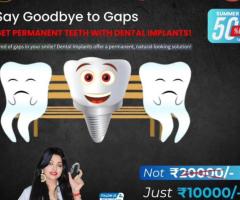 Missing a Tooth? Get It Fixed in Just ONE Visit! Free Consultation – Consult Today!