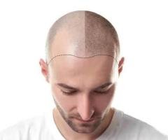 Hair Doctor Thrissur – Expert Care for Hair Loss and Scalp Health