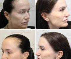Hair Doctor Thrissur – Expert Care for Hair Loss and Scalp Health