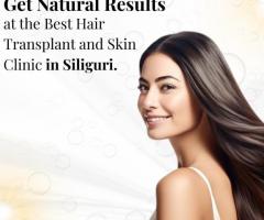 Get Natural Results at the Best Hair Transplant and Skin Clinic in Siliguri