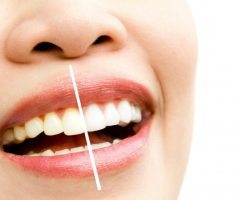 Modern Solutions for Healthy Teeth and Gums