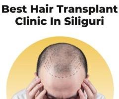 Best Hair Transplant Clinic In Siliguri