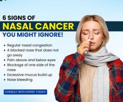 Nasal Cancer Treatment - Dr. Sidharth Pradhan
