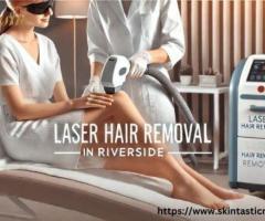 Experience Smooth Skin with Advanced Laser Hair Removal in Riverside