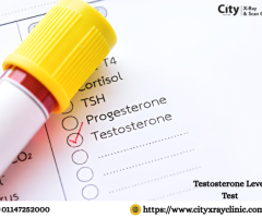 Testosterone Level Test Price What to Expect
