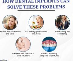 Nagu Dental Speciality | Full Mouth Implant In India