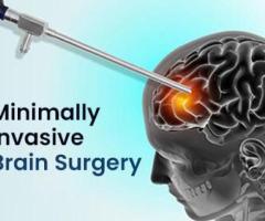 Best Neurosurgeon Noida