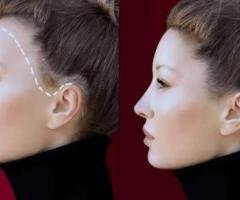 Hair Fixing in Thrissur: A Non-Surgical Solution for Hair Loss