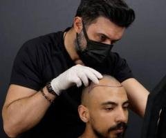 Hair Fixing in Thrissur: A Non-Surgical Solution for Hair Loss