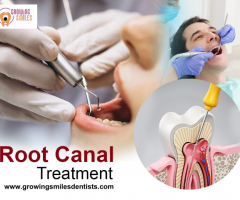 Affordable root canal treatment in Whitefield, Bangalore: Growing Smiles