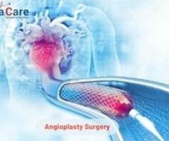 Affordable Angioplasty in India with EdhaCare