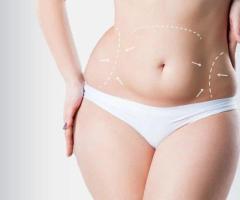 Top Benefits of Tummy Tuck Surgery You Didn’t Know