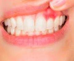 Healthy Gums Support Better Oral Health Every Day
