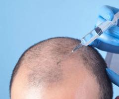Best Hair Loss Treatment - 1