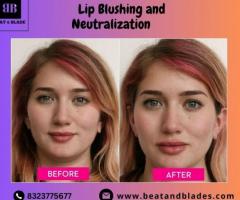 Best Lip Neutralization Treatment in Houston