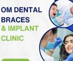 Best Dental Clinic in Patna: Om Dental Braces & Implant Clinic