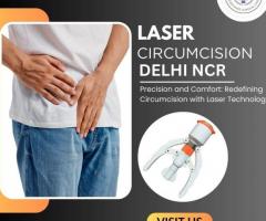 Stapler Circumcision Surgery in Noida