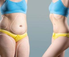 Tummy Tuck in Essex: Say Goodbye to Stubborn Belly Fat