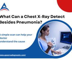 What Can a Chest X-Ray Detect Besides Pneumonia