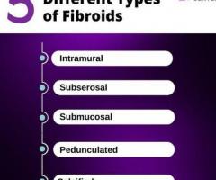 Exploring Fibroid Type for Better Understanding
