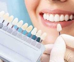Best Dental Clinic in Coimbatore With Top Dental Treatments