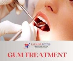 Gum Treatment in Tirunelveli