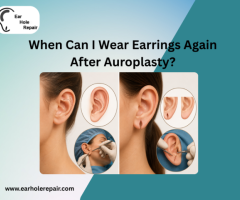 When Can I Wear Earrings Again After Auroplasty
