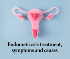 adenomyosis natural treatment in Delhi