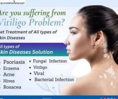 AROGYAM PURE HERBS KIT FOR VITILIGO